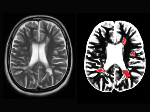 NeurOracle